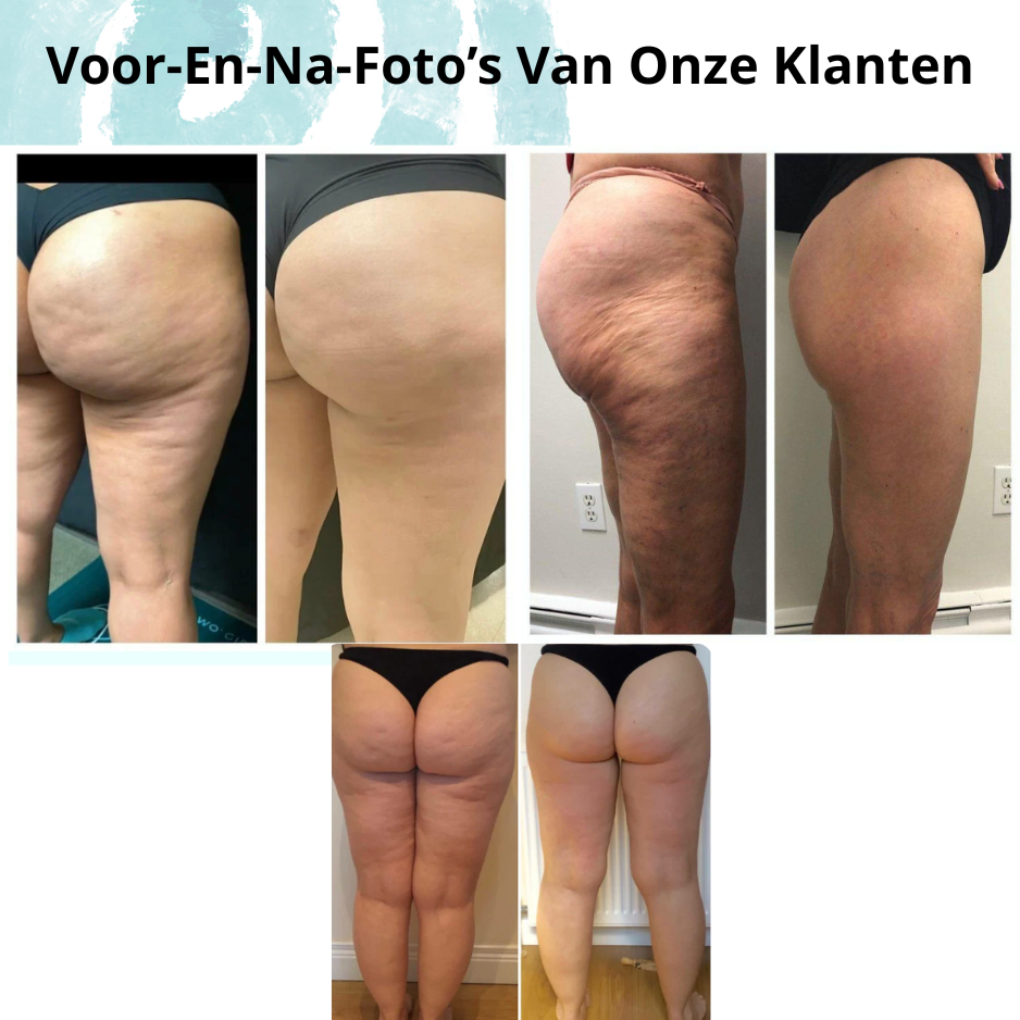 Nyome™ Body Sculptor